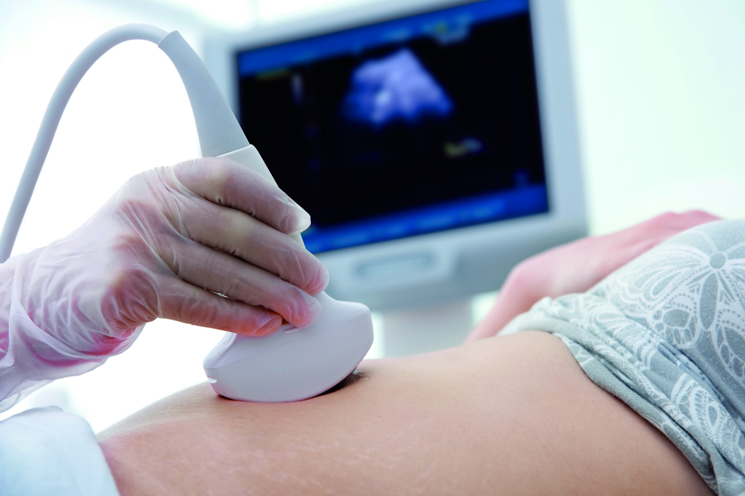 Obstetric Scanning: The role of ultrasound in first trimester screening